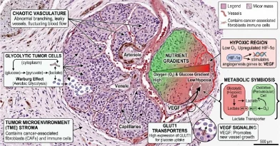 Cancer & vascular metabolism